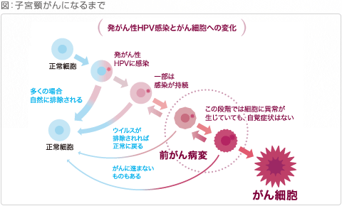 子宮頸がんになるまで